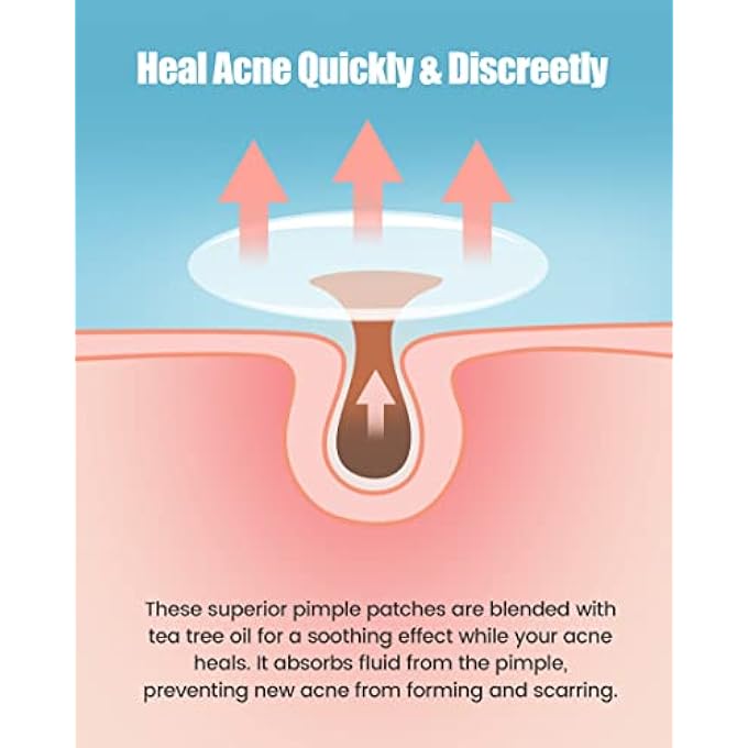 STRBOXONG PIMPLE PATCH 210 COUNTS 4 SIZES, HYDROCOLLIOD ACNE PATCH FOR FACE, INVISIBLE ZIT PATCH WITH TEA TREE OIL & CALENDULA OIL, BLEMISH PATCH, VEGAN AND CRUELTY FREE - Image 4